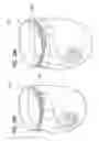 Fig. 27 - Absorbent article product line