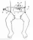 Fig. 01 - Diaper with umbilical feature