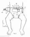 Fig. 03 - Diaper with umbilical feature