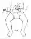 Fig. 04 - Diaper with umbilical feature