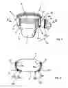 Fig. 02 - Pre-fastened absorbent sanitary product, a closure element therefor and related manufacturing process