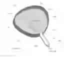 Fig. 16 - Nucleus Extraction from Spine Intervertebral Disc