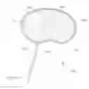 Fig. 27 - Nucleus Extraction from Spine Intervertebral Disc