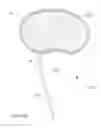 Fig. 28 - Nucleus Extraction from Spine Intervertebral Disc