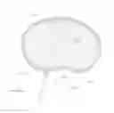 Fig. 35 - Nucleus Extraction from Spine Intervertebral Disc