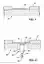 Fig. 02 - Arthroscopic chondrocyte implantation method and device