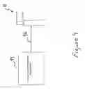 Fig. 05 - Method and apparatus for use in balancing ligaments of a knee