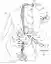 Fig. 02 - Intra-abdominal medical method