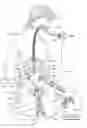 Fig. 03 - Intra-abdominal medical method