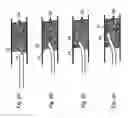 Fig. 03 - Image-guided laser catheter
