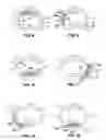 Fig. 09 - System and method providing directional ultrasound therapy to skeletal joints