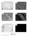 Fig. 18 - System and method providing directional ultrasound therapy to skeletal joints