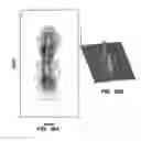 Fig. 30 - System and method providing directional ultrasound therapy to skeletal joints