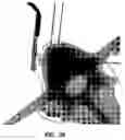Fig. 32 - System and method providing directional ultrasound therapy to skeletal joints