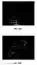 Fig. 46 - System and method providing directional ultrasound therapy to skeletal joints