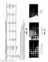 Fig. 51 - System and method providing directional ultrasound therapy to skeletal joints