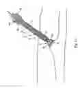 Fig. 11 - Tissue closure and tissue closing device