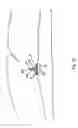 Fig. 13 - Tissue closure and tissue closing device