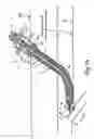 Fig. 17 - Tissue closure and tissue closing device