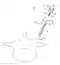 Fig. 01 - Multi-piece vertebral attachment device