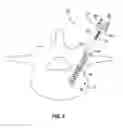 Fig. 03 - Multi-piece vertebral attachment device