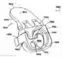 Fig. 01 - Inter-cervical facet joint implant with locking screw system