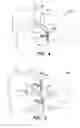 Fig. 04 - Inter-cervical facet joint implant with locking screw system