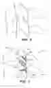 Fig. 05 - Inter-cervical facet joint implant with locking screw system