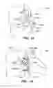 Fig. 09 - Inter-cervical facet joint implant with locking screw system