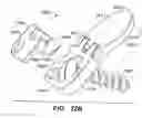 Fig. 14 - Inter-cervical facet joint implant with locking screw system
