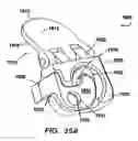 Fig. 17 - Inter-cervical facet joint implant with locking screw system