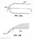 Fig. 25 - Inter-cervical facet joint implant with locking screw system
