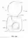 Fig. 30 - Inter-cervical facet joint implant with locking screw system