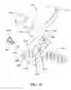Fig. 32 - Inter-cervical facet joint implant with locking screw system