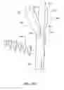 Fig. 33 - Inter-cervical facet joint implant with locking screw system