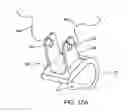 Fig. 17 - Interspinous vertebral and lumbosacral stabilization devices and methods of use