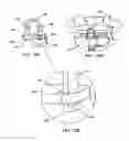 Fig. 20 - Interspinous vertebral and lumbosacral stabilization devices and methods of use