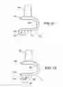 Fig. 22 - Interspinous vertebral and lumbosacral stabilization devices and methods of use