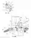 Fig. 29 - Interspinous vertebral and lumbosacral stabilization devices and methods of use