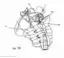 Fig. 40 - Interspinous vertebral and lumbosacral stabilization devices and methods of use