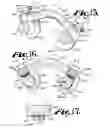 Fig. 07 - Hooked transverse connector for spinal implant system