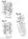 Fig. 04 - Polyaxial bone screw assembly with fixed retaining structure