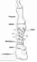 Fig. 01 - Metatarsal fixation plate
