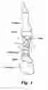 Fig. 02 - Metatarsal fixation plate