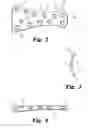 Fig. 03 - Metatarsal fixation plate