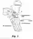 Fig. 02 - Plate for lengthening the lateral column of the foot