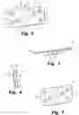 Fig. 03 - Plate for lengthening the lateral column of the foot