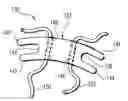 Fig. 01 - Implants and methods for inter-transverse process dynamic stabilization of a spinal motion segment