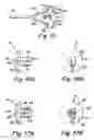 Fig. 06 - Method and apparatus for surgical repair
