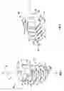 Fig. 02 - Multiple member interconnect for surgical instrument and absorbable screw fastener